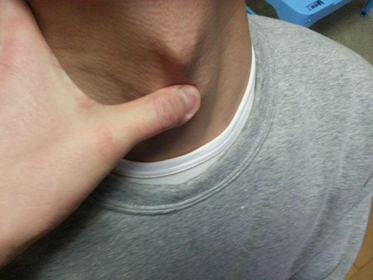 Adem Elması Özellikleri ve Faydaları Nelerdir?